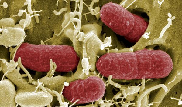 Klarsjön är infekterad med e.colibakterier. Foto: Reuters/TT /Arkivbild