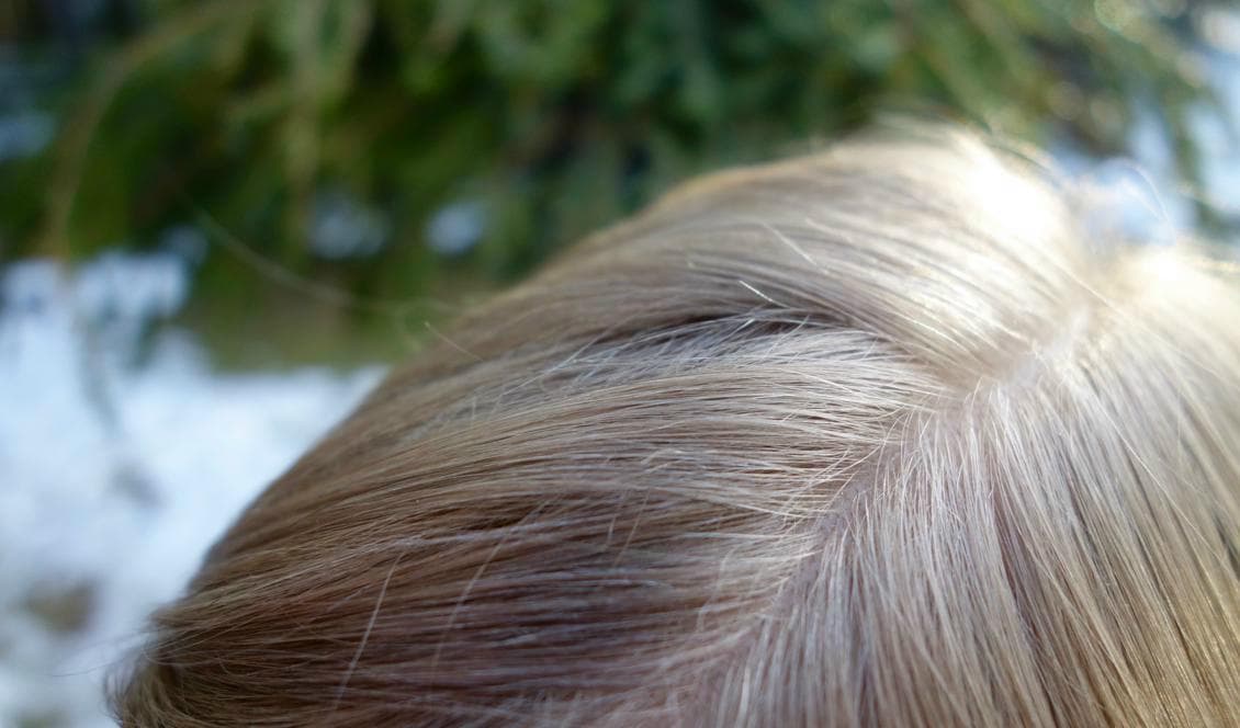 Klåda i hårbotten kan vara löss och i samband med skolstart är det bra att göra en koll med luskammen. Foto: Eva Sagerfors