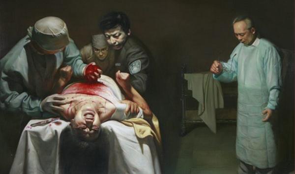 ”Organstöld”. En levande Falun Gong-utövare i Kina berövas på sina organ. Oljemålning av Xiqiang Dong. Foto: Xiqiang Dong