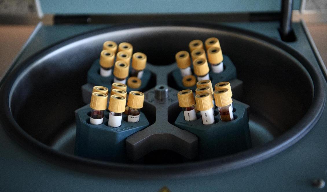 Antikroppstest genomförs genom blodprov. Foto: Jessica Gow/TT-arkivbild