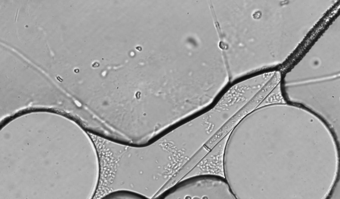 
Forskare på Lunds universitet har i flera år studerat ekosystemet under jorden. På bilden syns svamptråd i jorden som växer genom en luftbubbla och drar med sig en vattendroppe. I vattnet finns bakterier som kan simma längs tråden så länge vattnet räcker. Foto: Micaela Mafla-Endara                                            