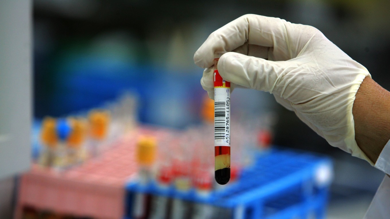 Peth-tester som mäter alkoholkonsumtion har fått hård kritik och Transportstyrelsen vill nu ändra reglerna för att dra in körkort. Foto: David Silverman/Getty Images