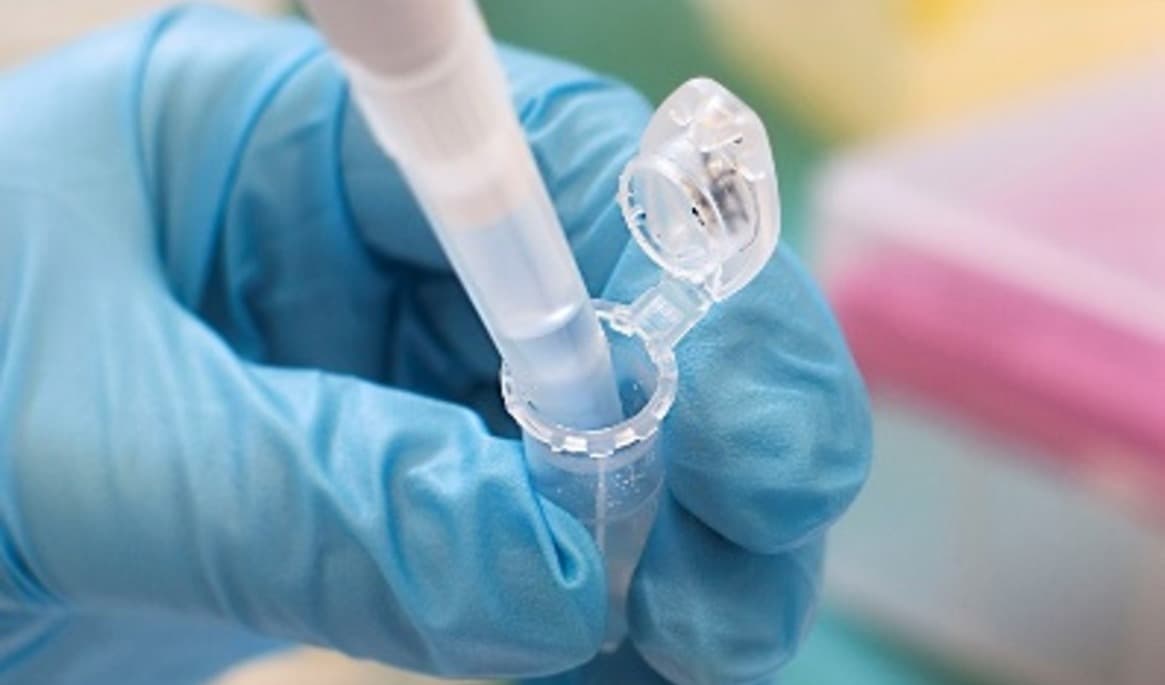 Den nya metoden kräver mycket dna från en enskild individ, därför fungerar den främst på spår av blod eller sperma. Foto: Nationellt Forensiskt Center, Polisen