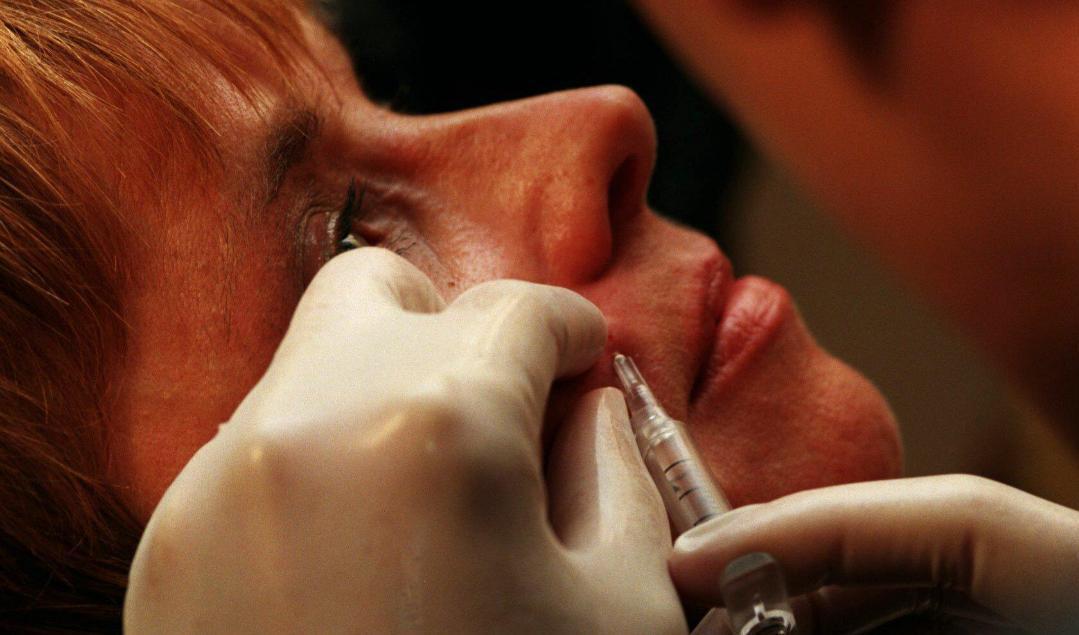 Fillers kan vara förfalskade, varnar läkare. Arkivbild. Foto: TT